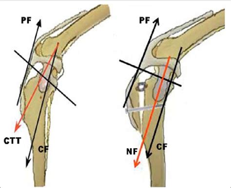 tibial thrust vs cranial drawer